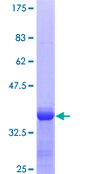 A2M (Human) Recombinant Protein (Q01)
