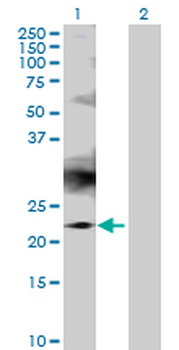 RAB7B MaxPab mouse polyclonal antibody (B01)