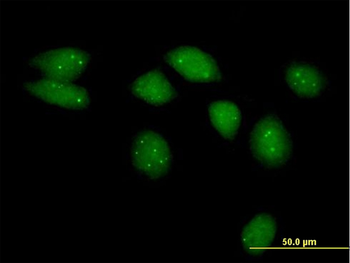 NSMCE2 MaxPab mouse polyclonal antibody (B01)