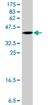 LASS6 polyclonal antibody (A01)