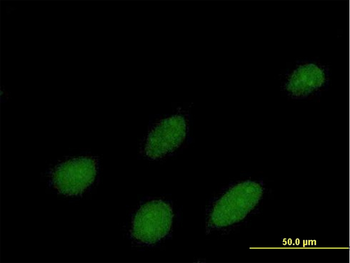 IPMK purified MaxPab mouse polyclonal antibody (B01P)