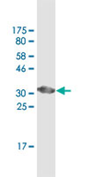 ATP6V0D2 monoclonal antibody (M01A), clone 7A4