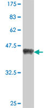 SPRED2 polyclonal antibody (A01)
