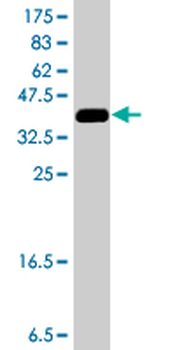 CNKSR3 polyclonal antibody (A01)