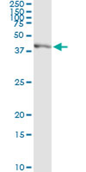 SGOL1 monoclonal antibody (M01), clone 3C11