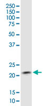 COMMD1 monoclonal antibody (M01), clone 2A12