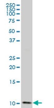 DYNLL2 polyclonal antibody (A01)
