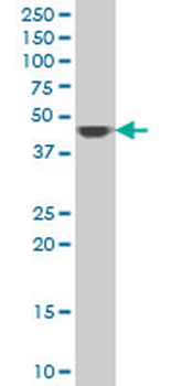 ACMSD polyclonal antibody (A01)