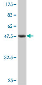 TRAPPC5 polyclonal antibody (A01)