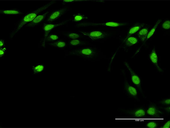 TWIST2 purified MaxPab rabbit polyclonal antibody (D01P)