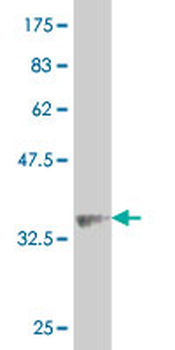 ALPK2 monoclonal antibody (M05), clone 4E5