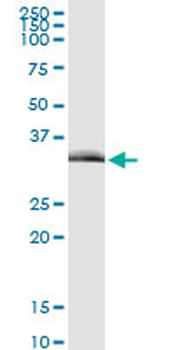 TIRAP MaxPab rabbit polyclonal antibody (D01)