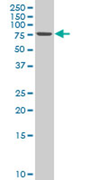 RHOT2 polyclonal antibody (A01)