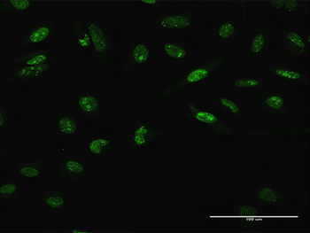 LHX4 purified MaxPab rabbit polyclonal antibody (D01P)