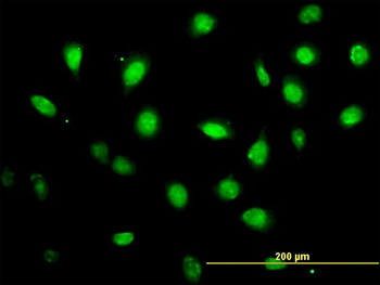 ZFYVE19 monoclonal antibody (M01), clone 4D5-2D11