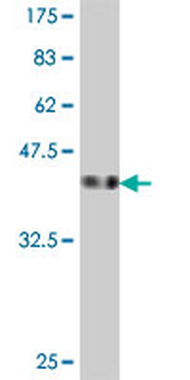 HINT2 polyclonal antibody (A01)