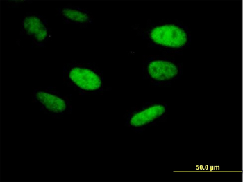 ING5 purified MaxPab mouse polyclonal antibody (B01P)