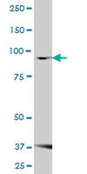 FBXO30 MaxPab mouse polyclonal antibody (B01)