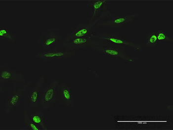RIOK1 purified MaxPab mouse polyclonal antibody (B02P)