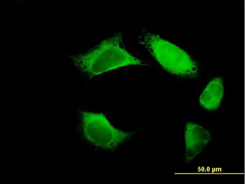 FERMT3 purified MaxPab mouse polyclonal antibody (B01P)