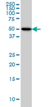 ADPGK monoclonal antibody (M01), clone 1E4