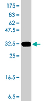 DIAPH3 polyclonal antibody (A01)