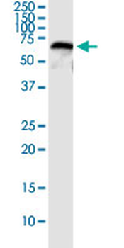 CFHR5 MaxPab rabbit polyclonal antibody (D01)