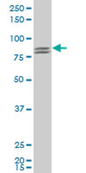 RUFY1 polyclonal antibody (A01)