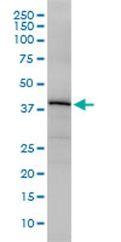 OBFC1 monoclonal antibody (M01), clone 3G12-1B7