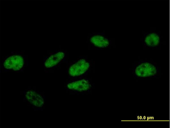 FBXO31 purified MaxPab mouse polyclonal antibody (B01P)