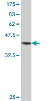 GEMIN7 polyclonal antibody (A01)