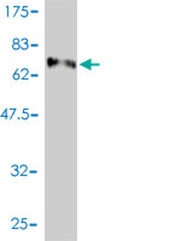 E2F8 monoclonal antibody (M01), clone 3E9-2F5