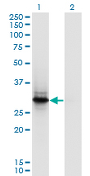 FYCO1 polyclonal antibody (A01)