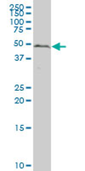 IRX1 polyclonal antibody (A01)