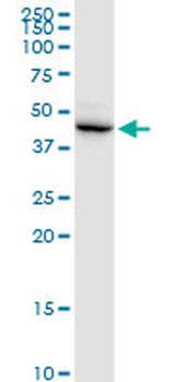 DSCC1 purified MaxPab mouse polyclonal antibody (B01P)