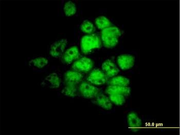 STK33 monoclonal antibody (M09), clone 1F10