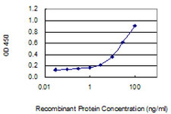 STK33 monoclonal antibody (M06), clone 4F7