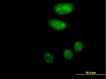 ISL2 purified MaxPab mouse polyclonal antibody (B01P)