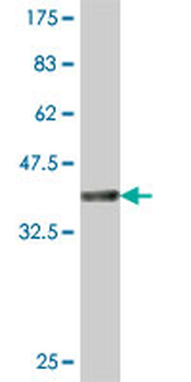 IPPK polyclonal antibody (A01)