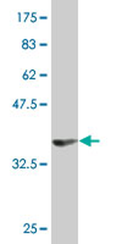 MPP5 monoclonal antibody (M01), clone 1D12