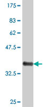 MPP5 polyclonal antibody (A01)