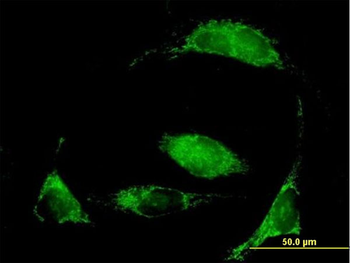 MCCC2 purified MaxPab mouse polyclonal antibody (B01P)