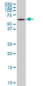 MCCC2 polyclonal antibody (A01)