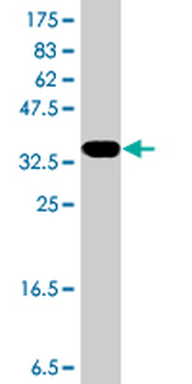 P53AIP1 polyclonal antibody (A01)