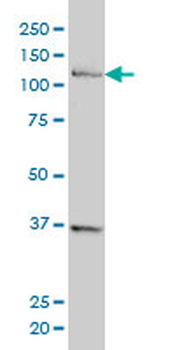 CHTF18 monoclonal antibody (M01), clone 1F5