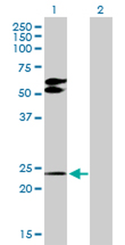 TGIF2 purified MaxPab rabbit polyclonal antibody (D01P)