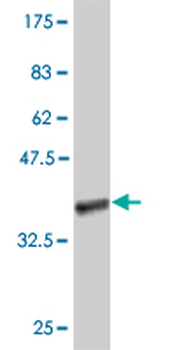 DNASE2B polyclonal antibody (A01)