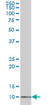 LSM2 polyclonal antibody (A01)