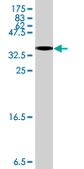 GPAM polyclonal antibody (A01)