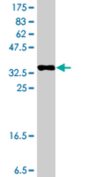 SH3RF1 polyclonal antibody (A01)